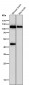 Anti-Phospho-IRE1 (S724) ERN1 Rabbit Monoclonal Antibody
